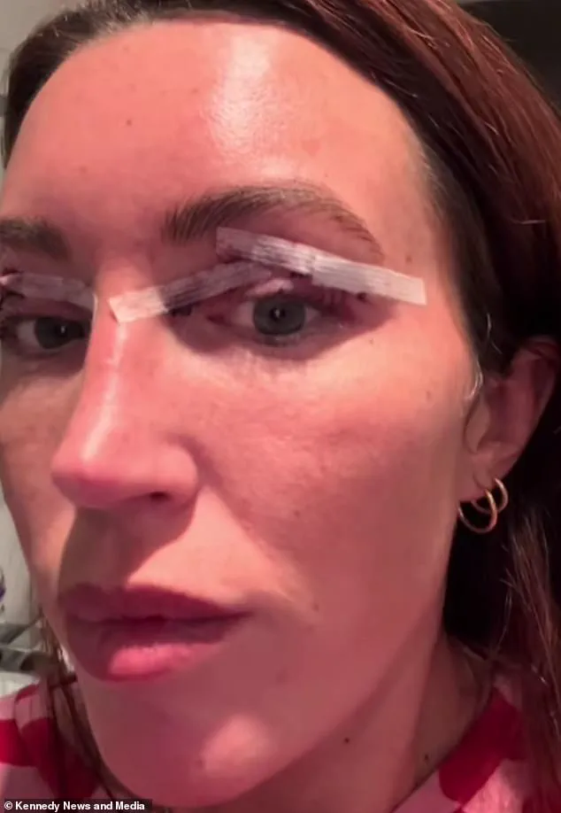 The Hidden Costs of Cosmetic Surgery: A Mother's Journey and Community Reflections on Self-Image and Surgery