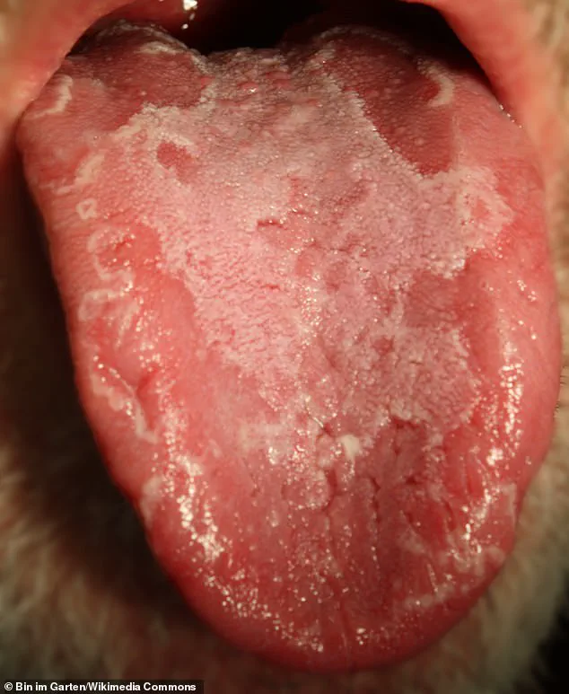 Kate McKinnon's Geographic Tongue: A Rare Medical Condition Unveiled in the Spotlight