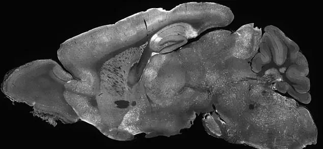 Breakthrough in Gene Therapy Offers New Hope for Treating Autism and Epilepsy