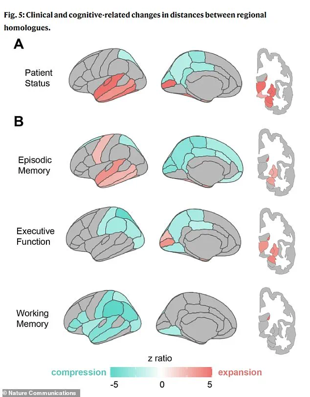 Privileged Access to Groundbreaking Discovery: Brain Shape Changes Signal Early Dementia Risk