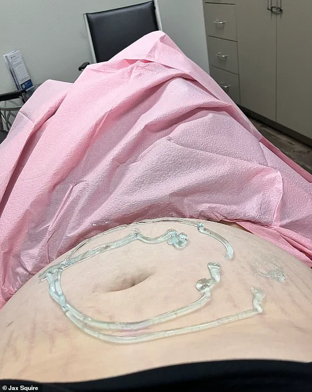The Regulatory Challenge: How Texas Directives Impact a Transgender Man's Pregnancy and Public Perception