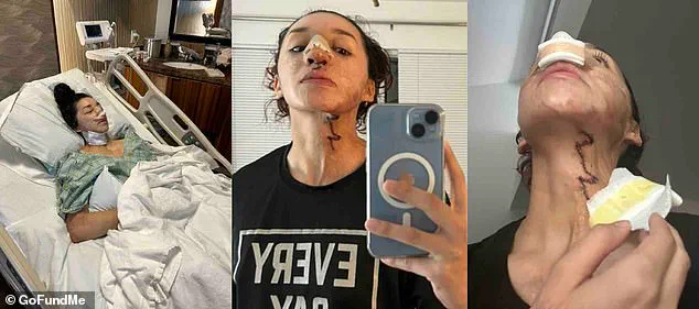 From Aspiration to Tragedy: The Community Risks of Gym Incidents at Planet Fitness