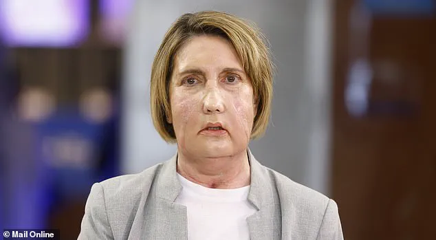 First-Ever Face Transplant from Euthanasia Donor Performed in Barcelona