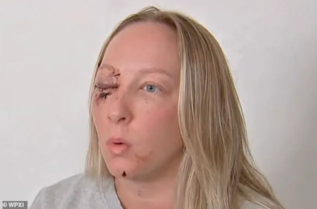 Massive Ice Slab From Tractor-Trailer Shatters Windshield, Leaves Mother Injured And Daughter Traumatized In Pennsylvania Crash