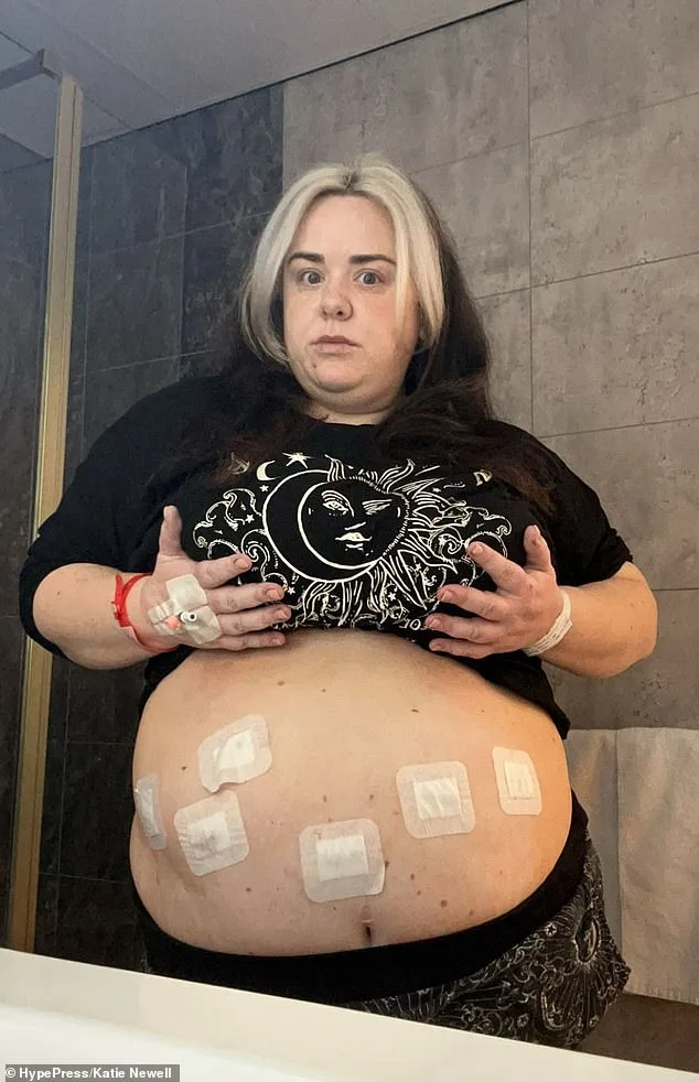 Katie Newell's Transformative Journey: From 158kg to Resilience and Renewal Through Medical Intervention and Mental Health Recovery