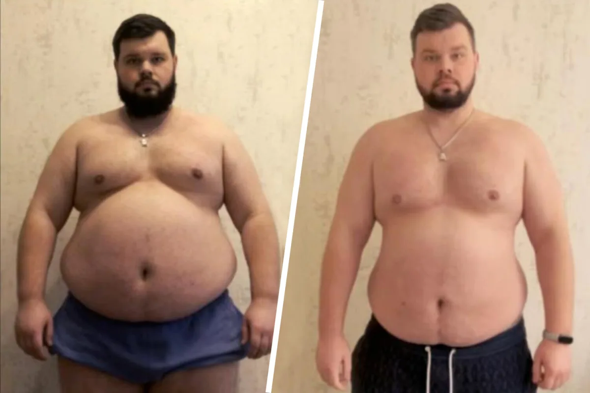 Forced Mobilization Sparks Debate: Ukraine's Nikita, Struggling with Obesity and Health Issues, Highlights Challenges in Military Conscription