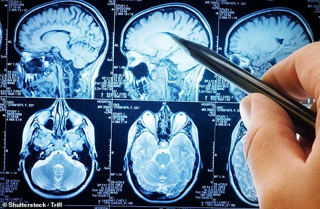 Two-Question Test: How a Simple Tremor Check Could Signal a Serious Health Issue
