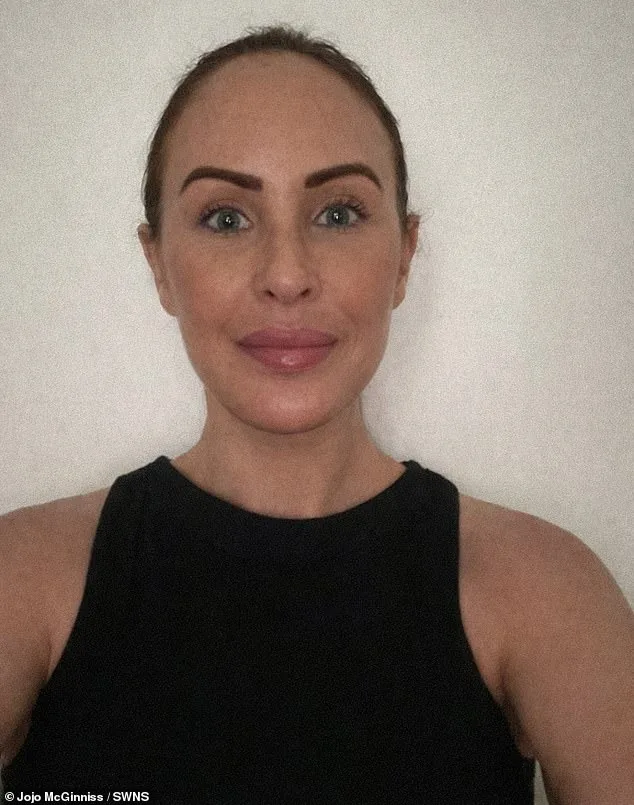 Over £10k Facelift in Turkey: Jojo McGinniss Faces Mixed Reactions After Transformative Surgery