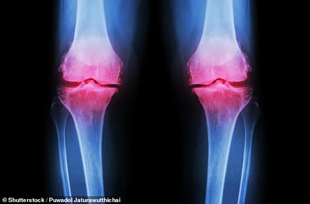Groundbreaking Lab-Grown Knee Offers Hope for 32 Million Americans with Osteoarthritis