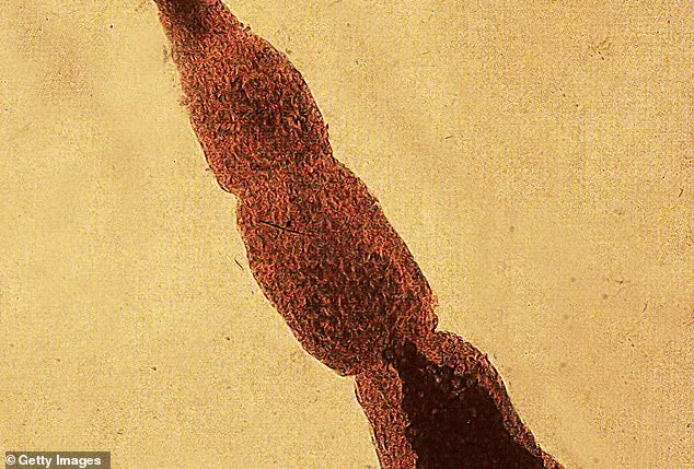 Urgent Alert: Deadly Fox Tapeworm Spreading in Pacific Northwest, Risks Human Health