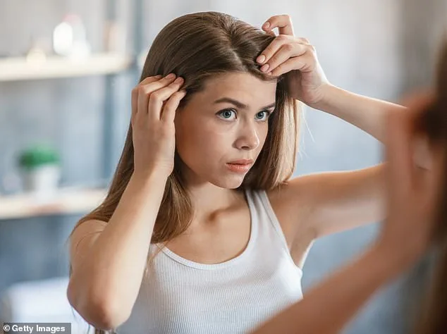 Dandruff Isn't Caused by Dry Skin—It's a Yeast Infection