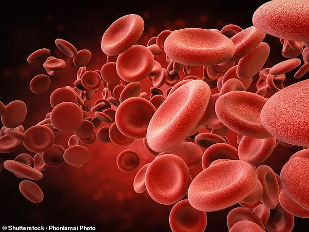 Iron Deficiency May Be a Key Risk Factor for Alzheimer's Disease